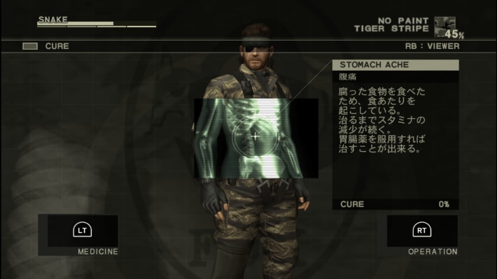 腹痛